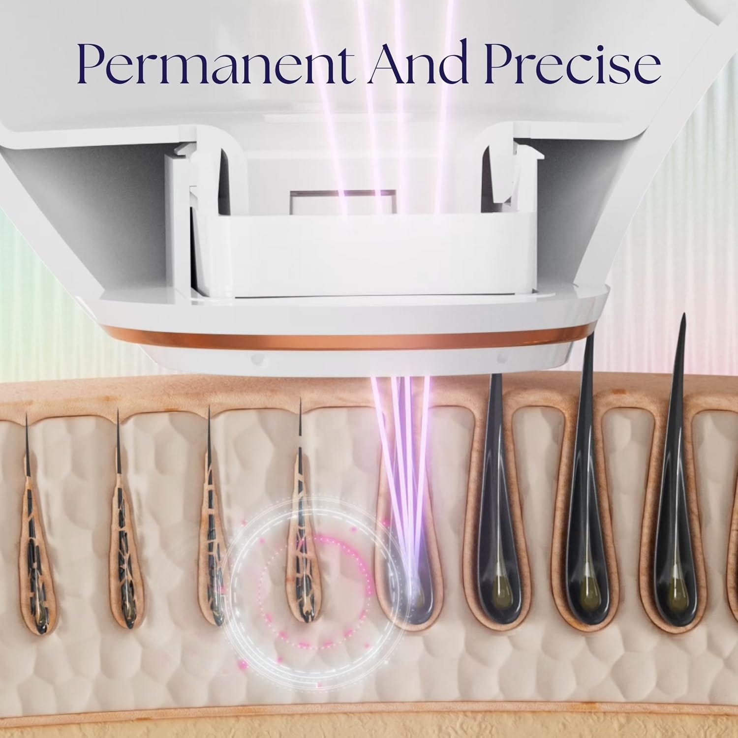 Epilaser targeting hair follicles with ultra precision