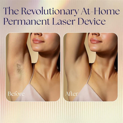 Woman's underarms before and after Epilaser treatment